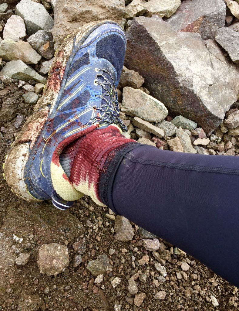 Now I Know How Wilderness First Aid Comes In Handy | The Runner's Trip ...