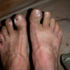 My feet about 100 miles into a 170-mile self-supported stage race in 2012, before I learned to tape them properly.